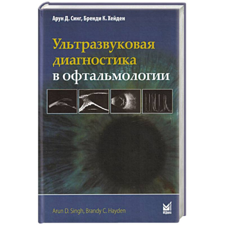 Диагностика. Методы и виды, книга Ультразвуковая диагностика в офтальмологии