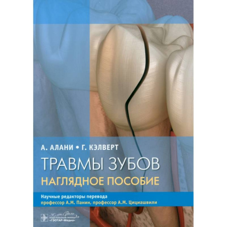 Специальная медицина, книга Травмы зубов. Наглядное пособие