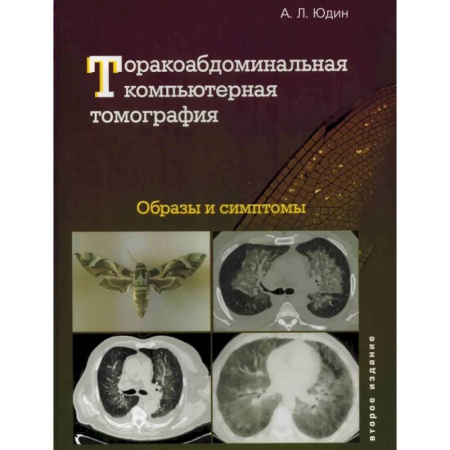 Специальная медицина, книга Торакоабдоминальная компьютерная томография. Образы и симптомы