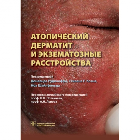 Книги, книга Атопический дерматит и экзематозные расстройства