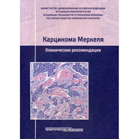 Специальная медицина, книга Карцинома Меркеля. Клинические рекомендации