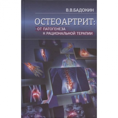 Специальная медицина, книга Остеоартрит: от патогенеза к рациональной терапии