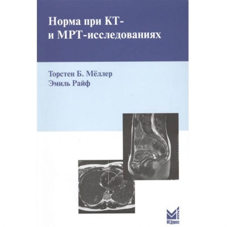 Фармакология. Рецептура. Токсикология, книга Норма при КТ- и МРТ-исследованиях. Мёллер Т.Б.