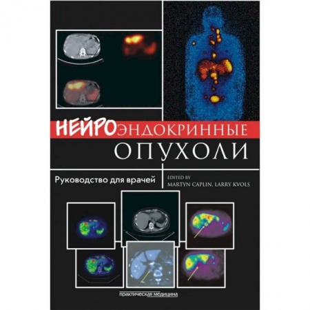 Специальная медицина, книга Нейроэндокринные опухоли. Руководство для врачей