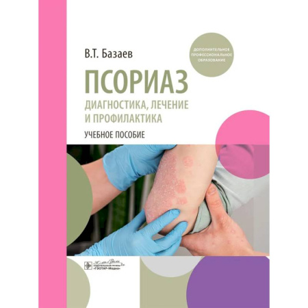 Медицинские энциклопедии и справочники, книга Псориаз. Диагностика, лечение и профилактика : учебное пособие