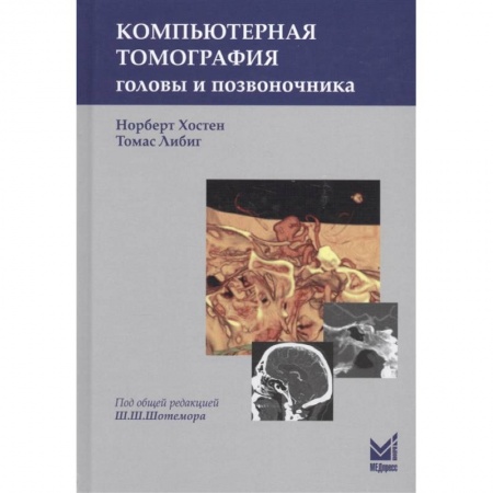 Специальная медицина, книга Компьютерная томография головы и позвоночника