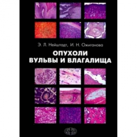 Специальная медицина, книга Опухоли вульвы и влагалища