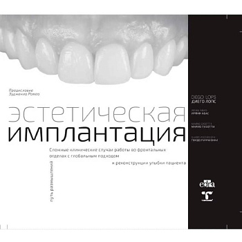 Эстетическая имплантация Эстетическая имплантация