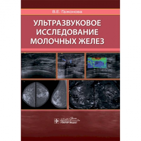 Диагностика. Методы и виды, книга Ультразвуковое исследование молочных желез