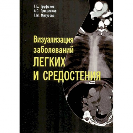Специальная медицина, книга Визуализация заболеваний легких и средостения
