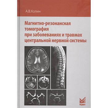 Магнитно-резонансная томография при заболеваниях и травмах центральной нервной системы Магнитно-резонансная томография при заболеваниях и травмах центральной нервной системы