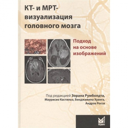 Медицинские энциклопедии и справочники, книга КТ- и МРТ- визуализация головного мозга. Подход на основе изображений