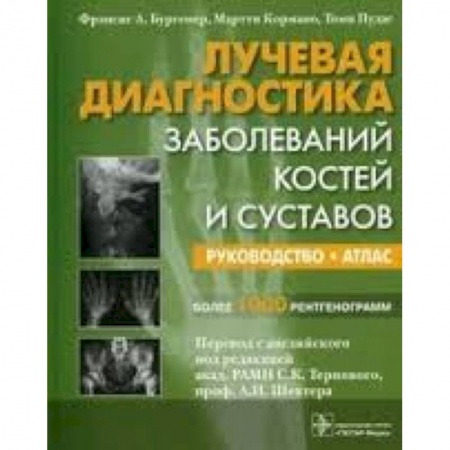 Диагностика. Методы и виды, книга Лучевая диагностика заболеваний костей и суставов
