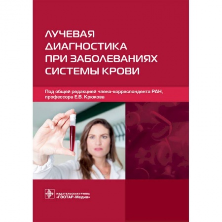 Диагностика. Методы и виды, книга Лучевая диагностика при заболеваниях системы крови