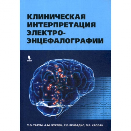 Специальная медицина, книга Клиническая интерпретация электроэнцефалографии
