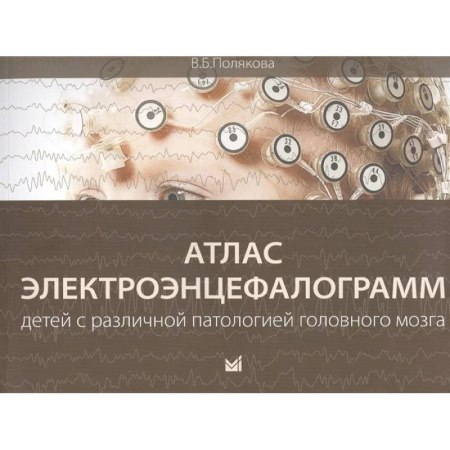 Специальная медицина, книга Атлас электроэнцефалограмм детей с различной патологией головного мозга