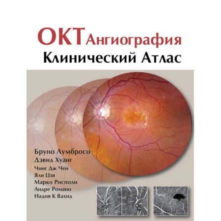 Специальная медицина, книга ОКТ-ангиография. Клинический атлас