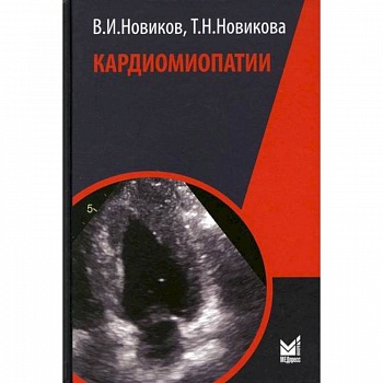 Кардиомиопатии Кардиомиопатии