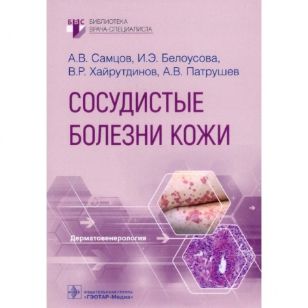 Основы медицинских знаний, книга Сосудистые болезни кожи