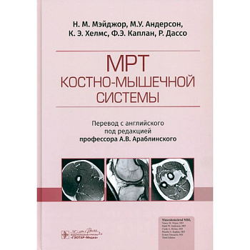 МРТ костно-мышечной системы