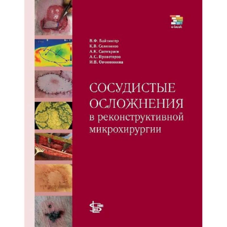 Специальная медицина, книга Сосудистые осложнения в реконструктивной микрохирургии