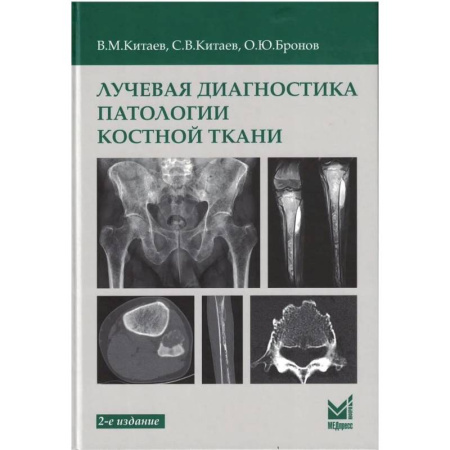 Медицинские энциклопедии и справочники, книга Лучевая диагностика патологии костной ткани