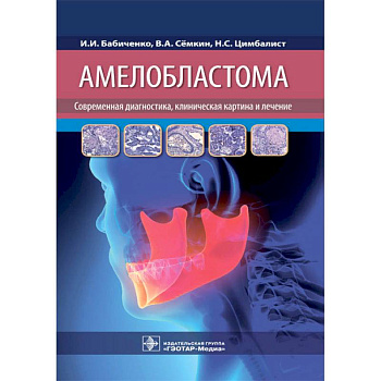 Амелобластома. Современная диагностика, клиническая картина и лечение Амелобластома. Современная диагностика, клиническая картина и лечение
