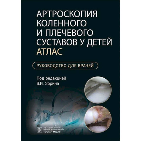 Специальная медицина, книга Артроскопия коленного и плечевого суставов у детей. Атлас : руководство для врачей