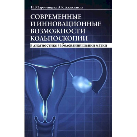 Медицинские энциклопедии и справочники, книга Современные и инновационные возможности кольпоскопии в диагностике заболеваний шейки матки.
