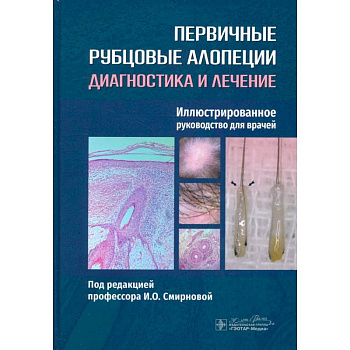 Первичные рубцовые алопеции. Диагностика и лечение. Иллюстрированное руководство для врачей