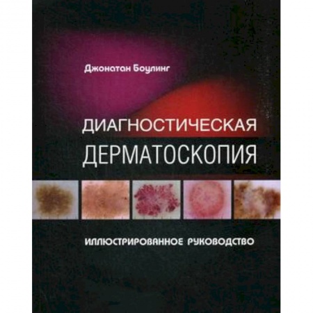 Специальная медицина, книга Диагностическая дерматоскопия. Иллюстрированное руководство