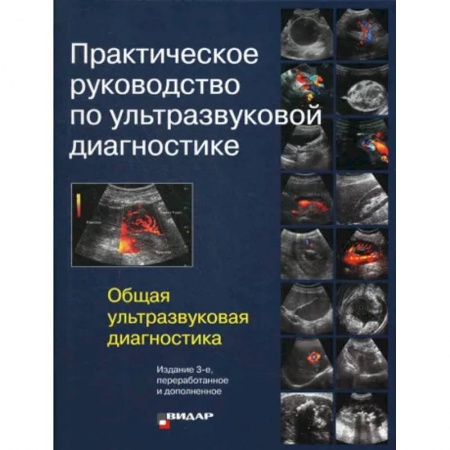 Диагностика. Методы и виды, книга Практическое руководство по ультразвуковой диагностике. Общая ультразвуковая диагностика