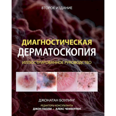 Специальная медицина, книга Диагностическая дерматоскопия: иллюстрированное руководство