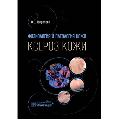 Специальная медицина, книга Физиология и патология кожи. Ксероз кожи