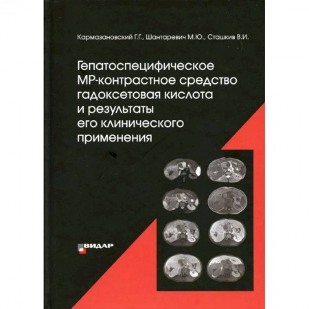 Книги, книга Гепатоспецифическое МР-контрастное средство «гадоксетовая кислота» и результаты его клинического применения'. Кармазановский Г.Г., Шантаревич М.Ю., Сташкив В.И.