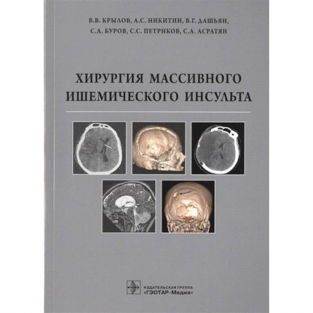 Специальная медицина, книга Хирургия массивного ишемического инсульта