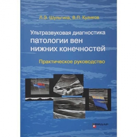 Диагностика. Методы и виды, книга Ультразвуковая диагностика патологии вен нижних конечностей: практическое руководство