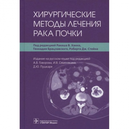 Специальная медицина, книга Хирургические методы лечения рака почки