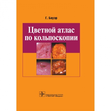 Специальная медицина, книга Цветной атлас по кольпоскопии