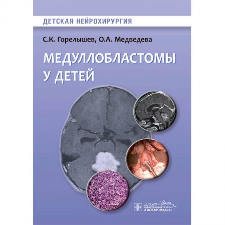 Специальная медицина, книга Медуллобластомы у детей