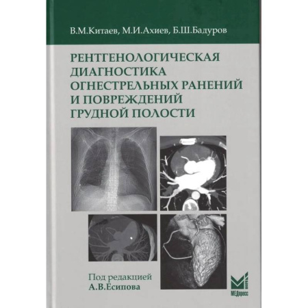 Диагностика. Методы и виды, книга Рентгенологическая диагностика огнестрельных ранений и повреждений грудной полости