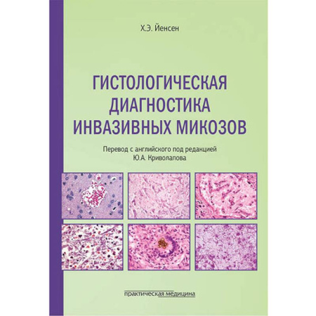 Медико-биологические дисциплины, книга Гистологическая диагностика инвазивных микозов