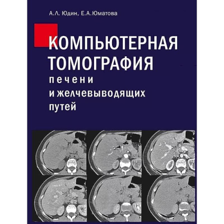 Диагностика. Методы и виды, книга Компьютерная томография печени и желчевыводящих путей: практическое руководство