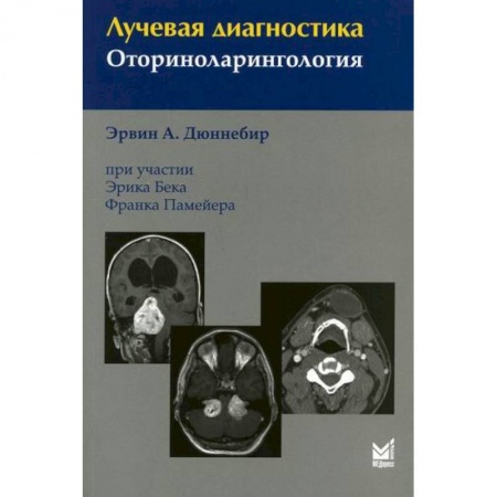 Диагностика. Методы и виды, книга Лучевая диагностика. Оториноларингология