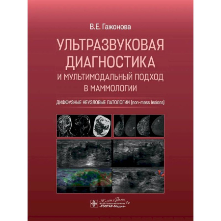 Медицинские энциклопедии и справочники, книга Ультразвуковая диагностика и мультимодальный подход в маммологии. Диффузные неузловые патологии