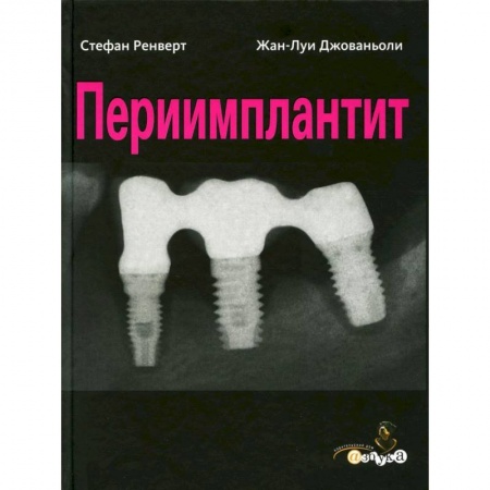Специальная медицина, книга Периимплантит