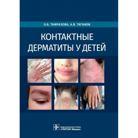 Специальная медицина, книга Контактные дерматиты у детей