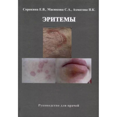 Специальная медицина, книга Эритемы. Руководство для врачей