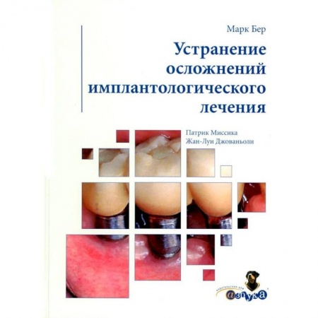 Специальная медицина, книга Устранение осложнений имплантологического лечения