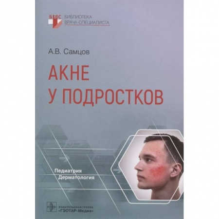 Книги, книга Акне у подростков